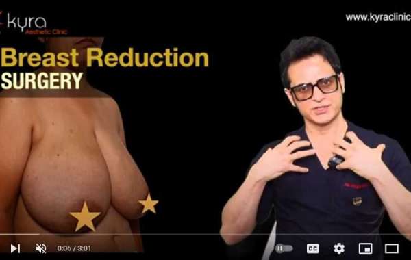 Breast Reduction in Punjab: A Comprehensive Guide